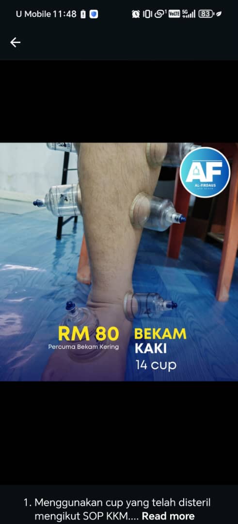 Galeri Al-Firdaus Spa Bekam